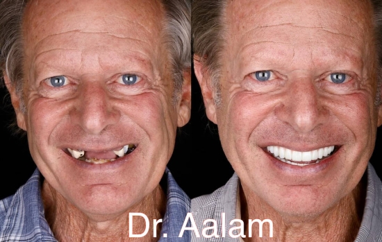 Cannot view this image? Visit: https://images.newsfilecorp.com/files/10740/273283_figure2_550.jpg