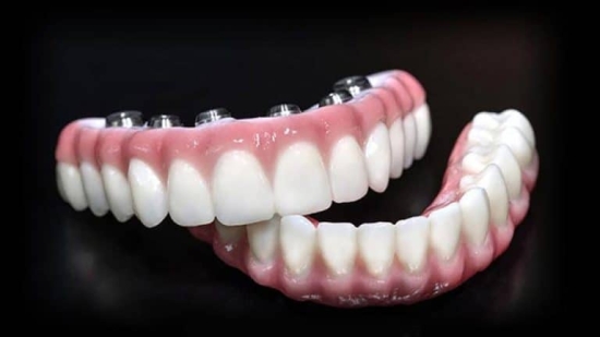 Cannot view this image? Visit: https://images.newsfilecorp.com/files/10740/276119_figure2_550.jpg