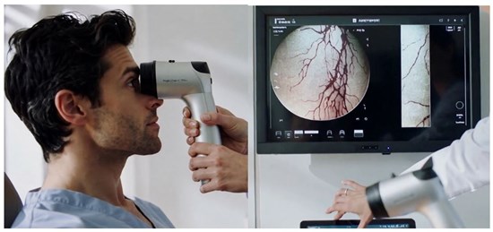 Cannot view this image? Visit: https://images.newsfilecorp.com/files/11754/297199_diagnostear_550.jpg