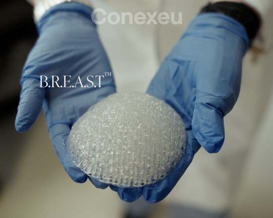 Cannot view this image? Visit: https://images.newsfilecorp.com/files/11946/297916_cxu_3d_breast_bb_550.jpg