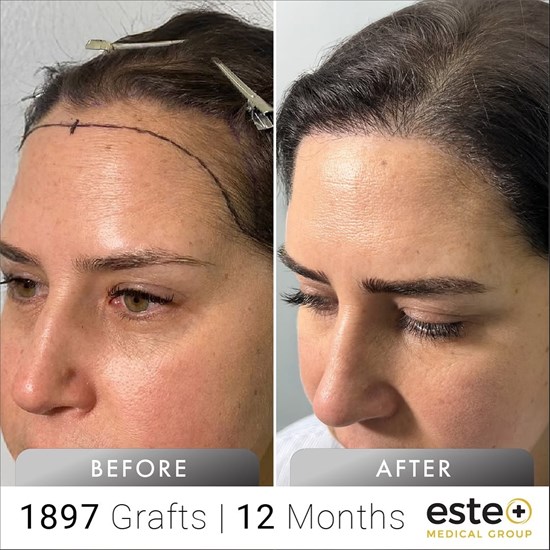 Cannot view this image? Visit: https://images.newsfilecorp.com/files/9032/288595_75be4aae74b939ee_003.jpg